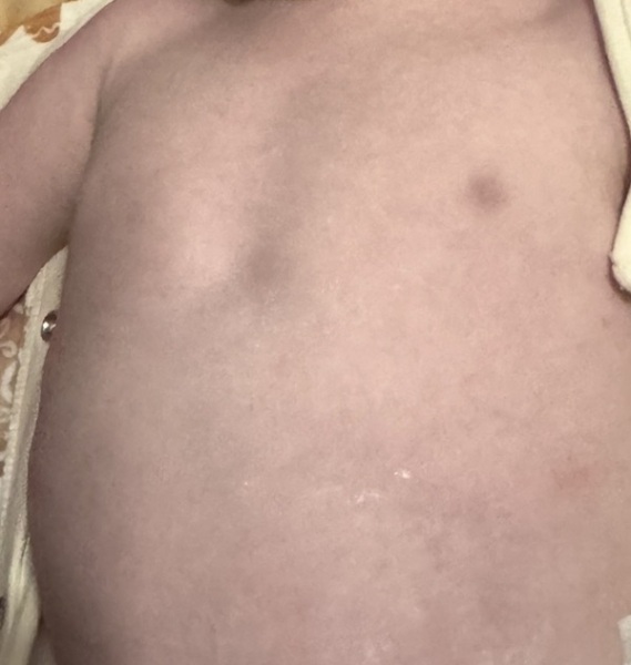 Little dip in chest