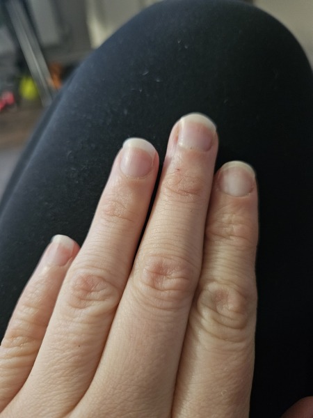What really worked for you to improve your nails!