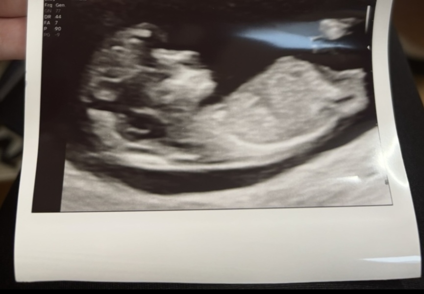 September 2025 babies