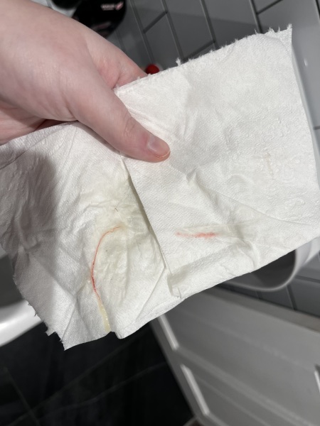 14 weeks - red blood in discharge