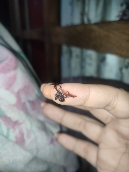 Warning TMI - brown clot 4.5 weeks