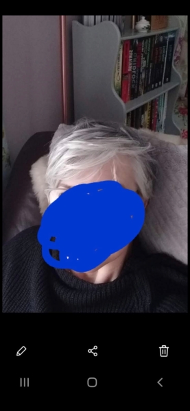 Grey hair wobble