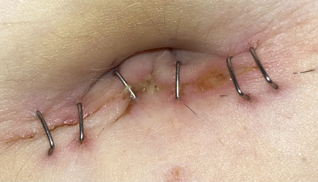 Does this look infected to you?