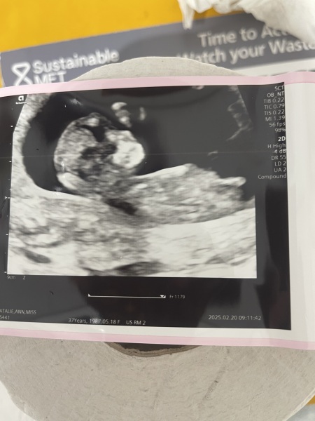 Anyone guess my gender