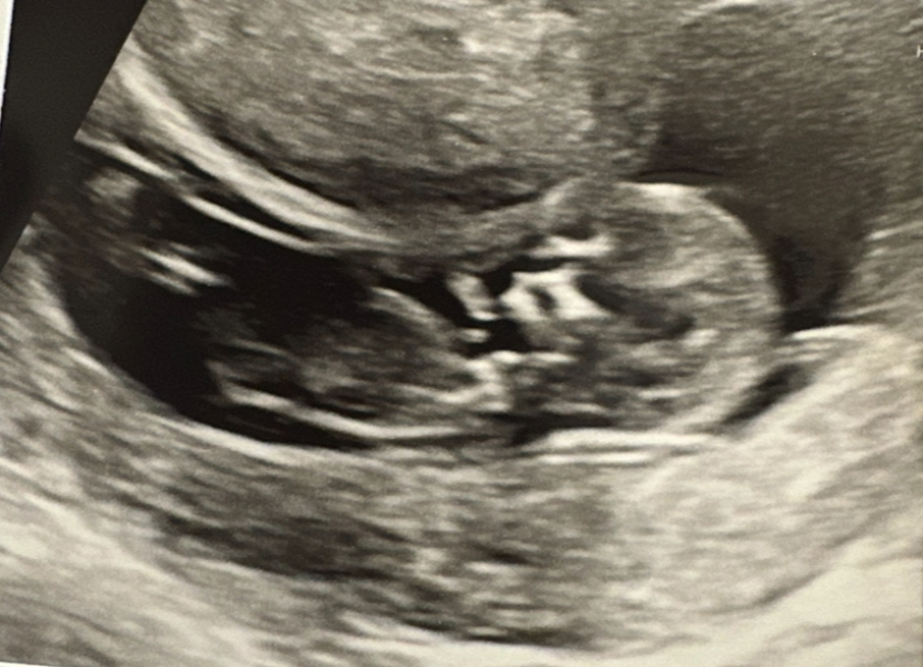 What do you think my baby will be? Nub theory