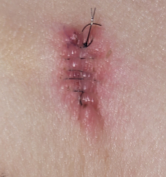 Is this normal healing?