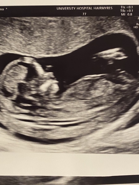Boy or Girl