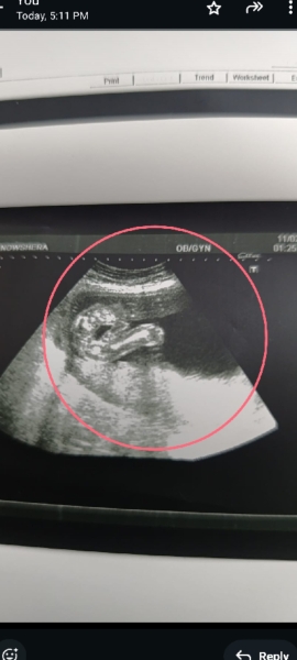 gender prediction