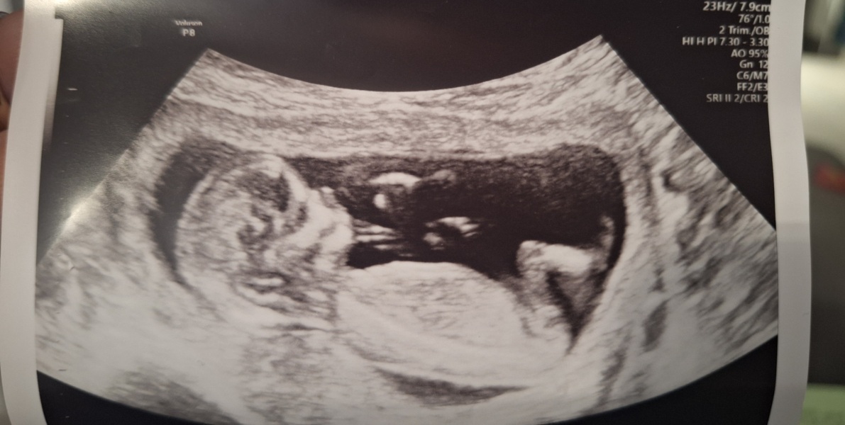 Gender prediction
