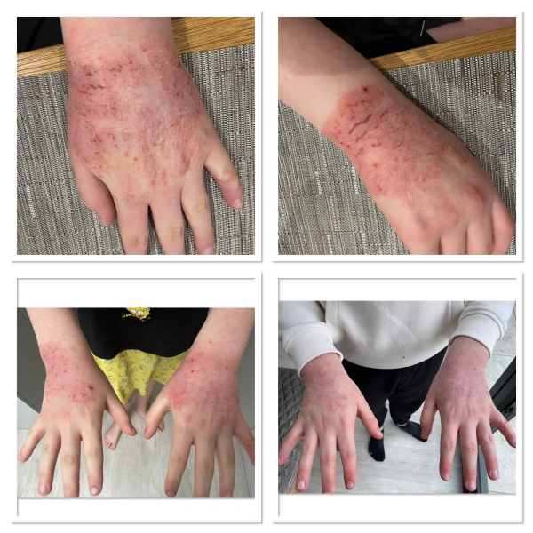 Help me sort my hands out!