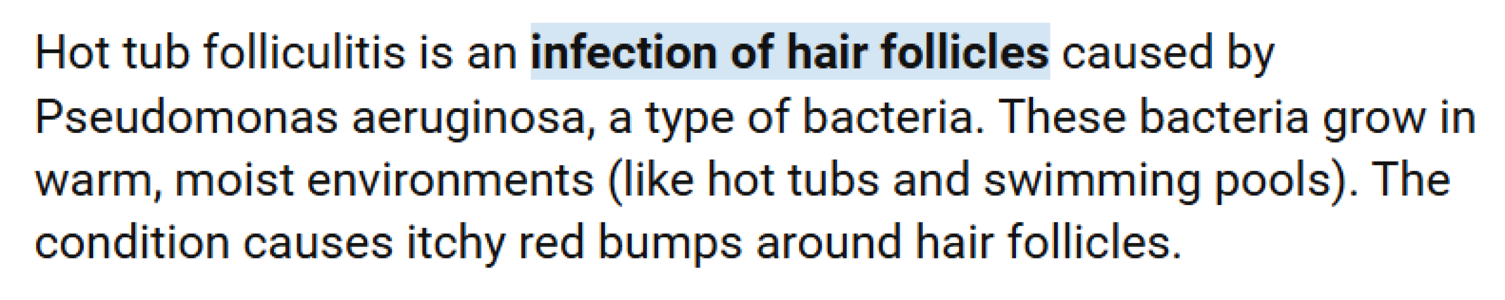 Let spa know or not?