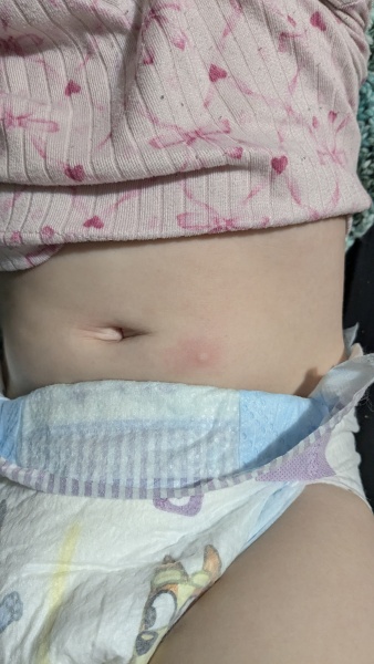 Toddler random spots