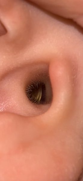 What’s this in my child’s ear?!