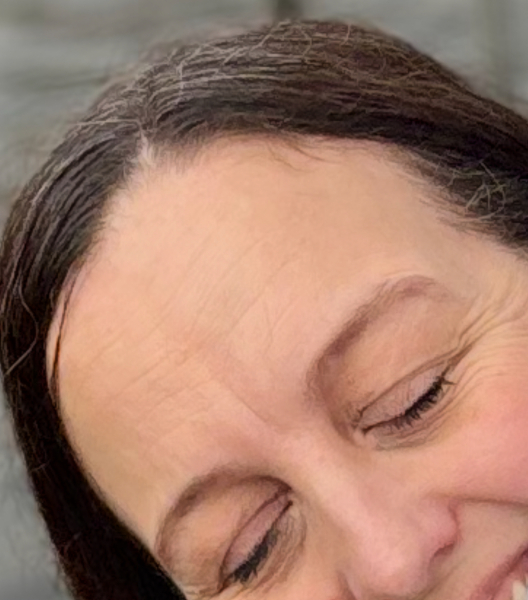 Aging badly