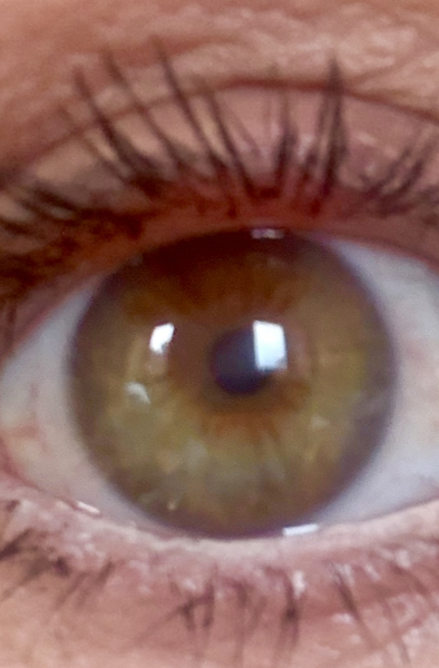 What colour eyes are these?