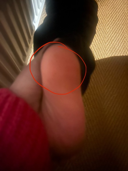 6 year old DS with sore foot