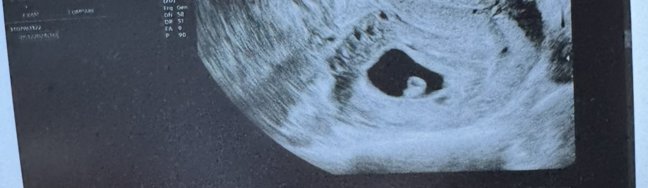 Scan