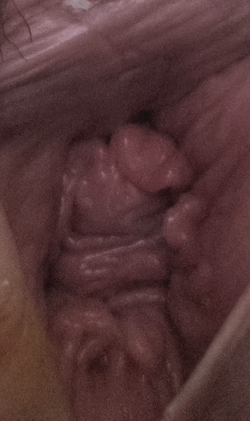 ****WARNING Grapic imagine**** are my bits normal?