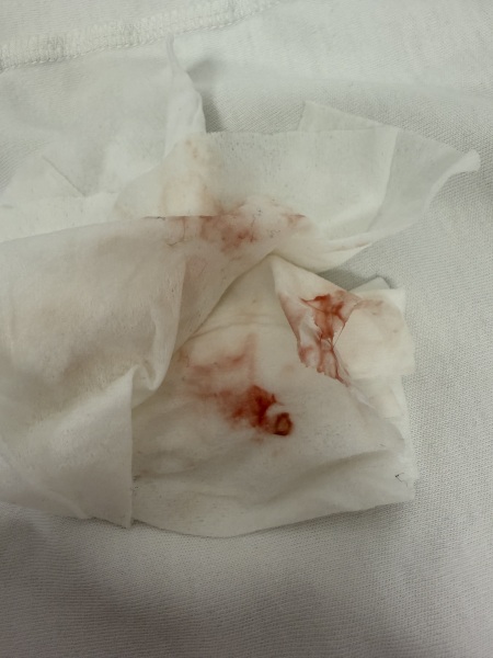 TMI Implantation bleeding or AF? TMI WARNING