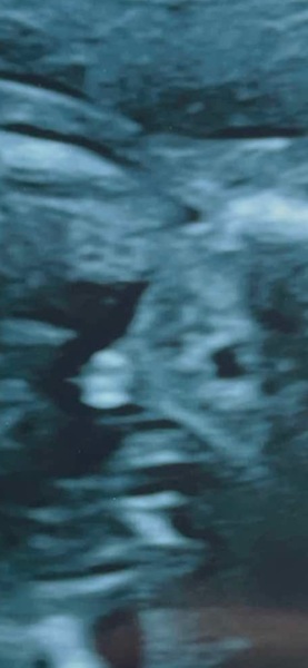 Boy or girl?