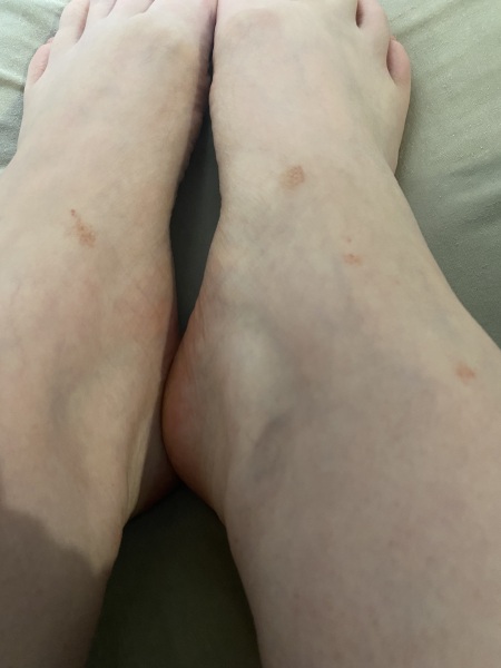 When to worry about rash