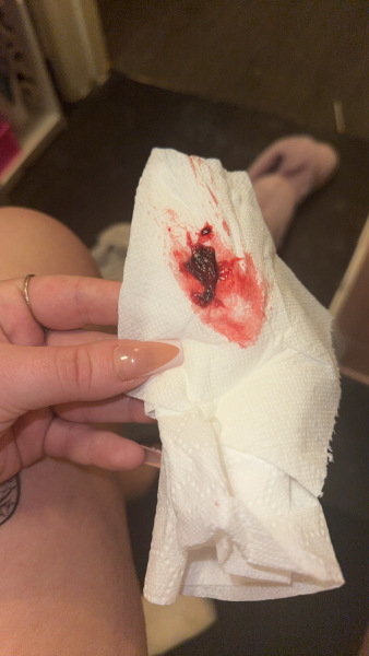 Am I having a miscarriage?
