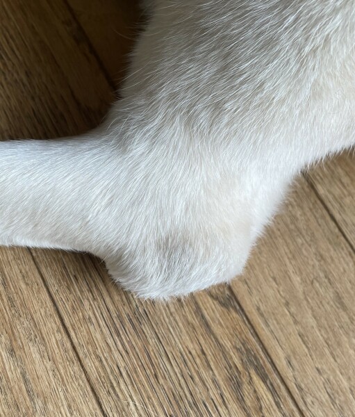PRP injections for very advanced elbow arthritis - any experiences?
