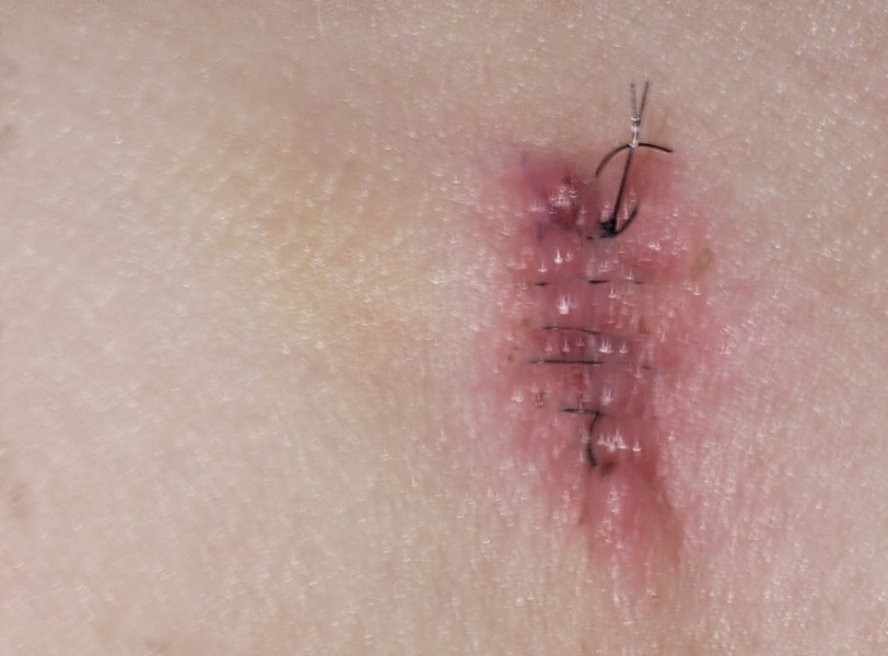 Is this normal healing?