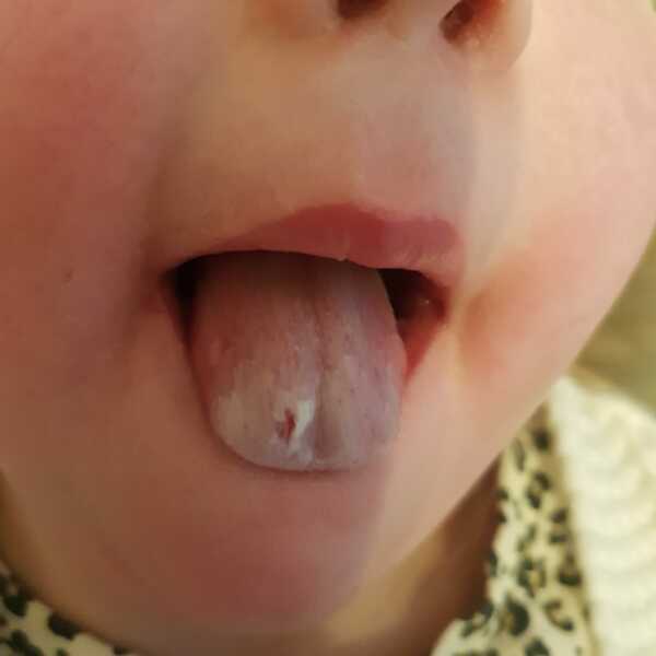 What is this?