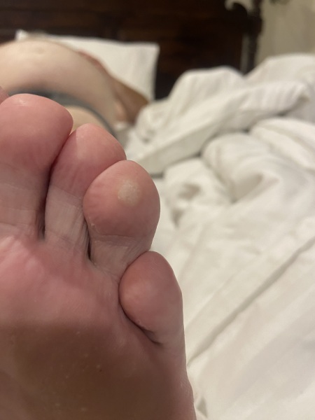 What is this on my foot?