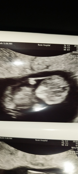 TTC February 2024 ✨