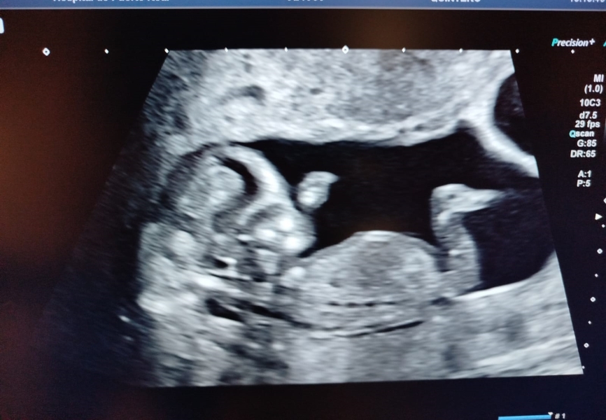 OMG! It's triplets!!!