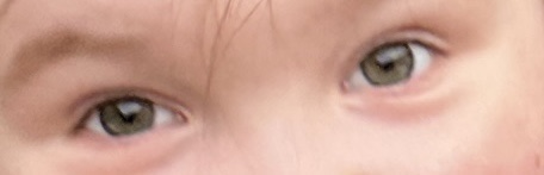 What colour eyes are these?
