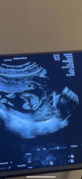 Would you say this is a boy,