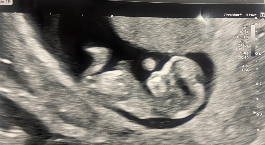 Do people think boy or girl?