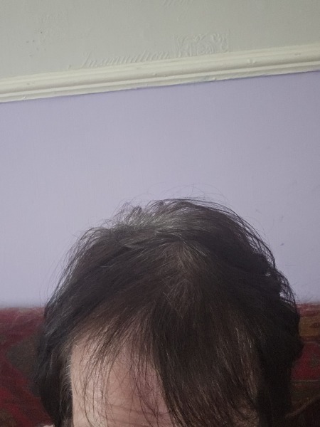 Hair dye stripper any good?