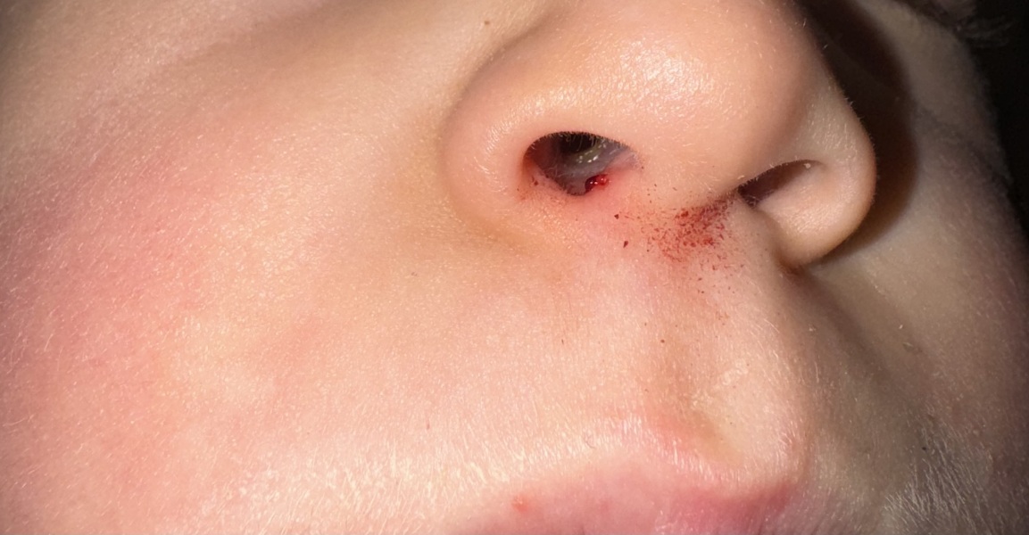 Would you worry over this?