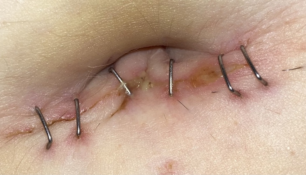 Does this look infected to you?