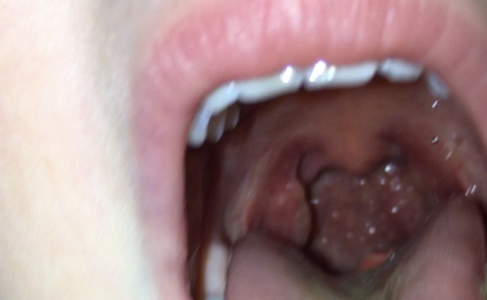 Daughter’s throat - opinions please