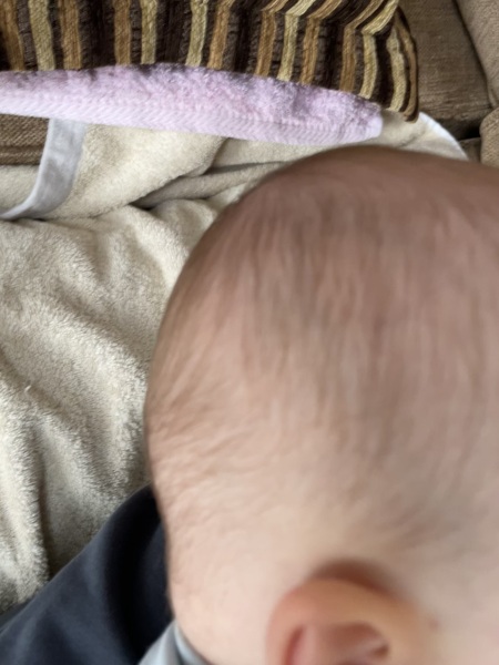 Colour of baby’s hair