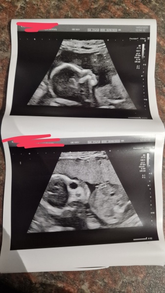 Re scan done - want opinions :)