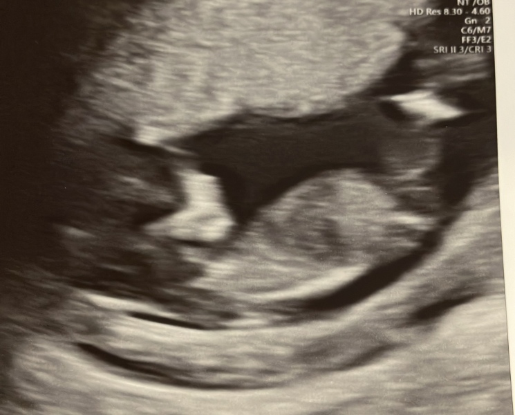 Due September 2025 part 2