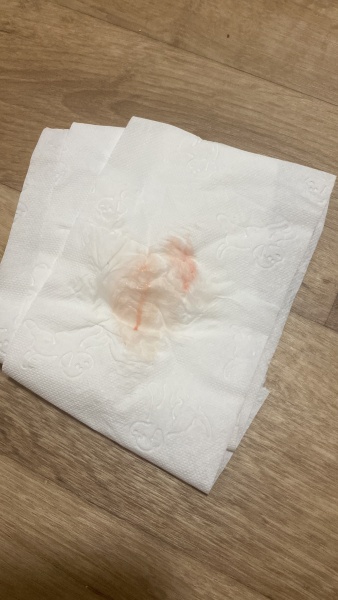 Tmi post! Could this be implantation bleeding?