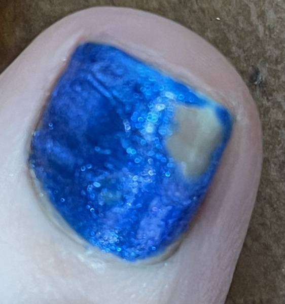 I have such bad luck with having my nails done. Tips please.