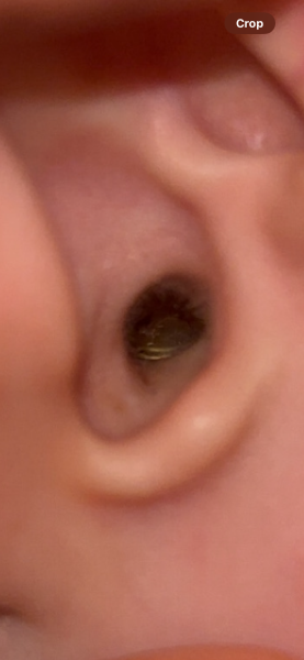 What’s this in my child’s ear?!