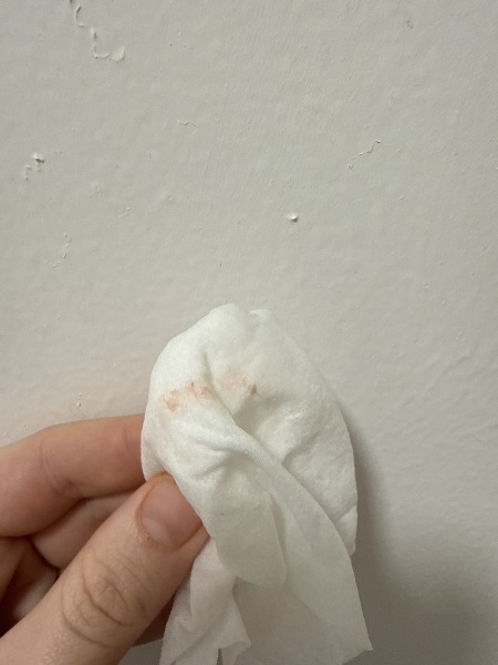 Implantation bleed - TMI Picture