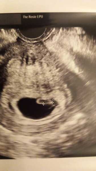 TTC February 2024 ✨