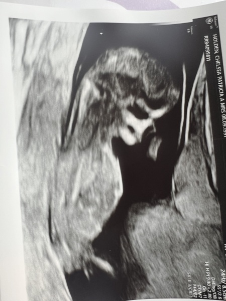 Boy or girl