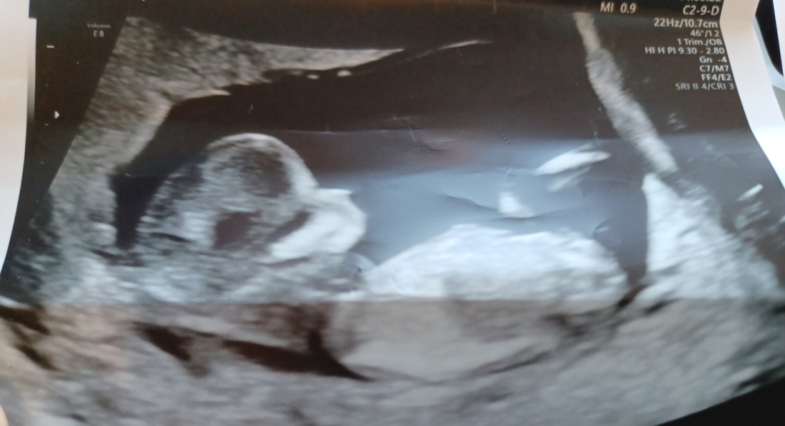 12+2 days any guesses? Skull/nub theory