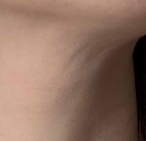 Sagging neck already, at 37?!